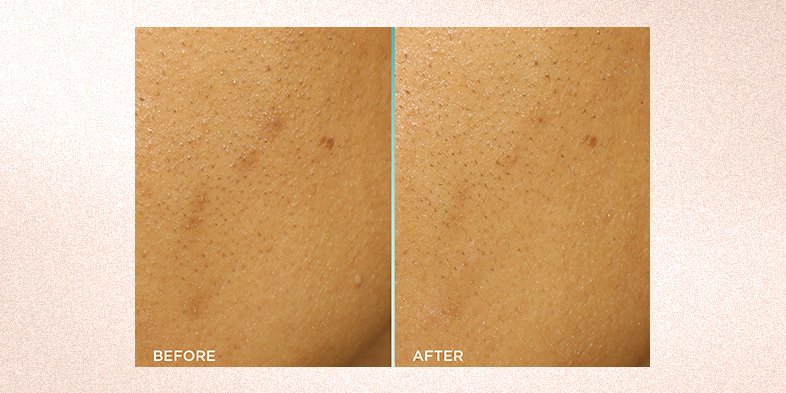 InArticlehowtoevenskintoneBright Reveal Peel BA